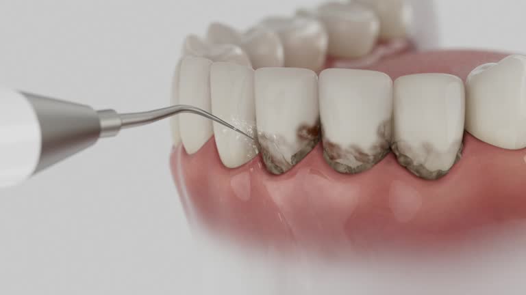 Reliable Dental contractor in Imlay City, MI by Dentist Open Now